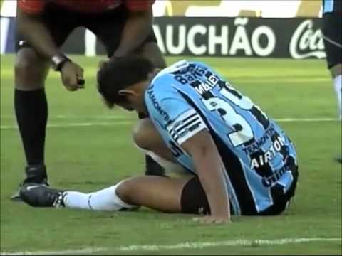 MBG Analisa - Grêmio 3 x 1 Caxias