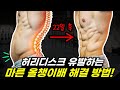 팔 다리는 가는데 유독 배만 볼록 튀어나온 사람은 이 습관 때문입니다 올챙이배 해결 방법