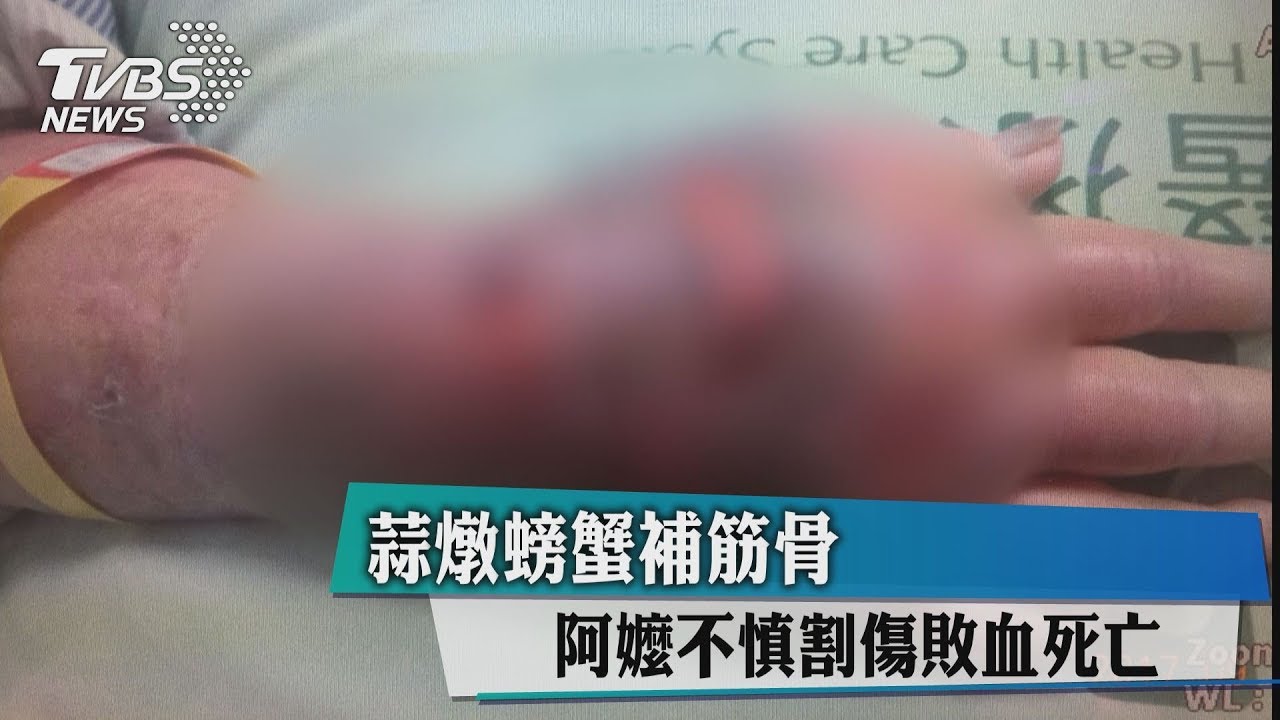 蒜燉螃蟹補筋骨 阿嬤不慎割傷敗血死亡
