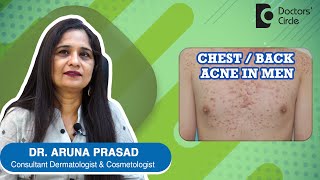 CHEST / BACK ACNE IN MEN. How to get rid of Chest Acne in Men? - Dr. Aruna Prasad | Doctors