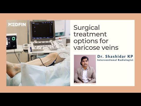 Varicose Veins: Surgical Treatment Options
