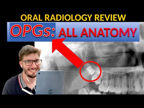 Quick & Easy Review: ALL Orthopantomogram (OPG) ANATOMICAL LANDMARKS, Dental Panoramic radiographs