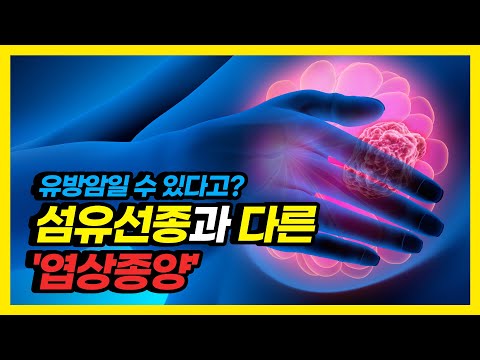 유방에서 빠른 속도로 자라는 엽상종양! 치료법은?