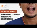 Do this to STOP SNORING and prevent SLEEP APNEA! Tongue Slide - Myofunctional Therapy | 1 of 5