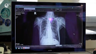 Едва 21 души се възползваха от безплатните прегледи за туберкулоза в Кърджали