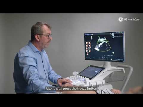 How to perform a 2nd trimester 3D scan easily and quickly? 