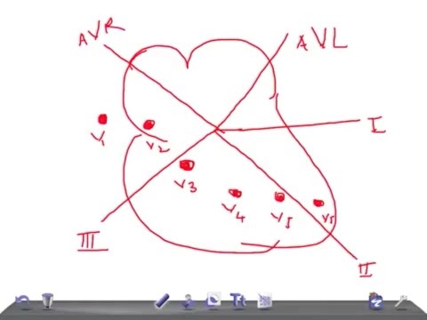EKG/ECG made simple & easy: Normal waves of EKG R & S waves and its Variation