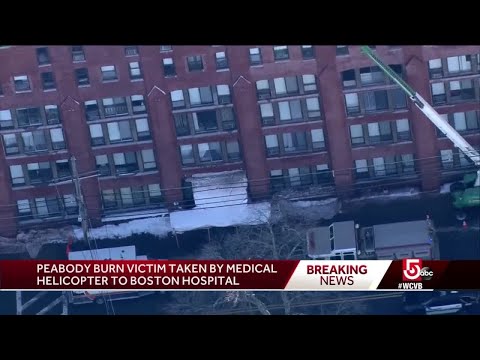 1 burned in Peabody fire