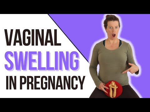 Eliminate VAGINAL SWELLING during pregnancy
