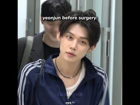 yeonjun 🤭 #txt #yeonjun #shortsfeed #fyp #kpop  #tomorrow_x_together #ggum #lusthyun