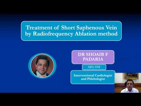 Treating Varicose Veins with RFA
