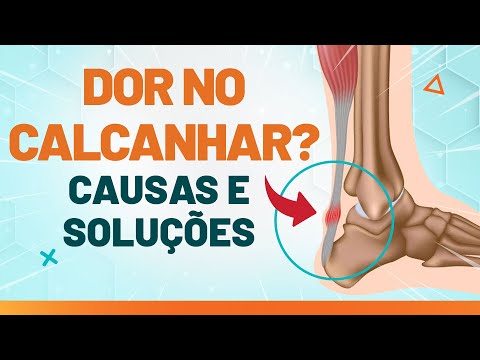 DOR NO CALCANHAR, O QUE FAZER? - Fisioprev