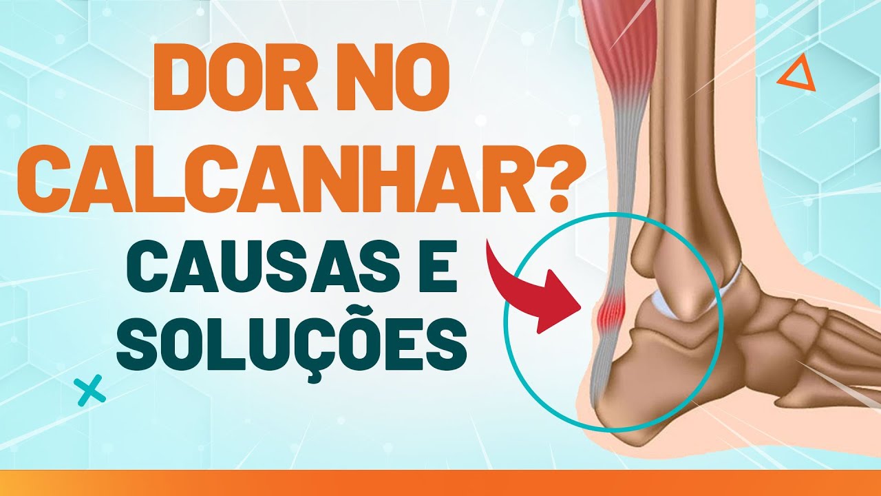 DOR NO CALCANHAR, O QUE FAZER? - Fisioprev