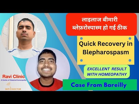 Quick Recovery of Blepharospasm with Homeopathy Dr Ravi Singh