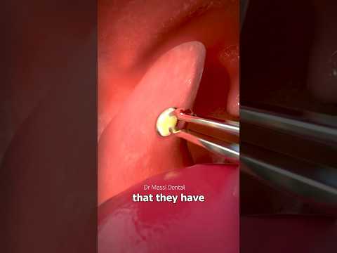 Smells BAD your mouth!        #viral#mouth#smell#smile#flossing #brushing#hygiene#shorts #mouthwash