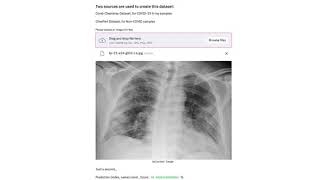 Covid-19- X-Ray Classification - PyTorch/Streamlit/Docker/Linode