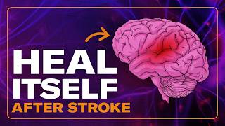 Can your brain heal itself after a stroke? – How to maximize your chances