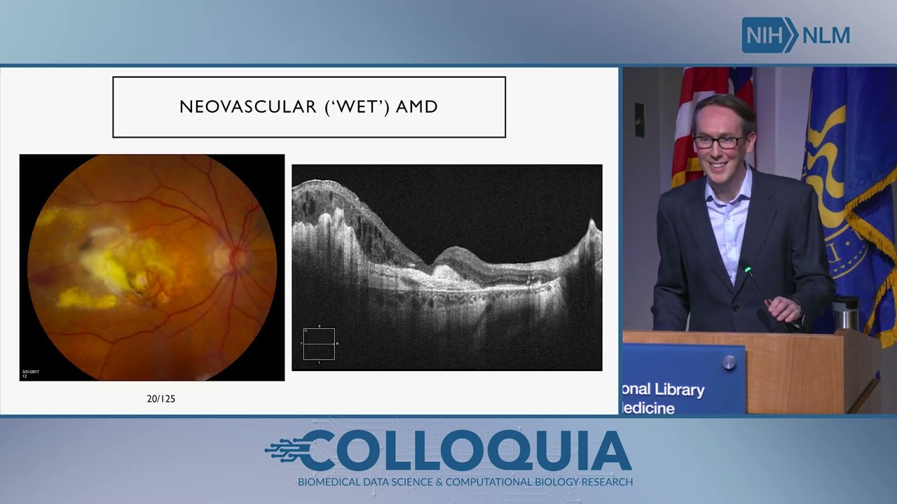 Diverse Applications of Computational Research and Artificial Intelligence in Ophthalmology