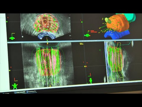 Brachyterapia na raka prostaty