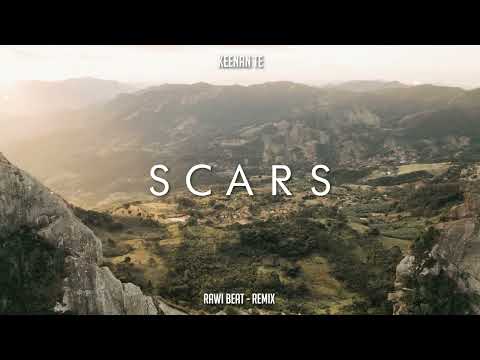 JEDAG JEDUG !!! Rawi Beat - Scars - ( New Remix )