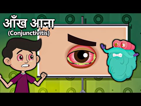 आँख आना | कंजंक्टिवाइटिस | What Causes Conjunctivitis In Hindi | Dr.Bincos Show | Educational Videos