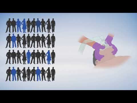 Does sleep apnea make it harder for patients to undergo anesthesia?