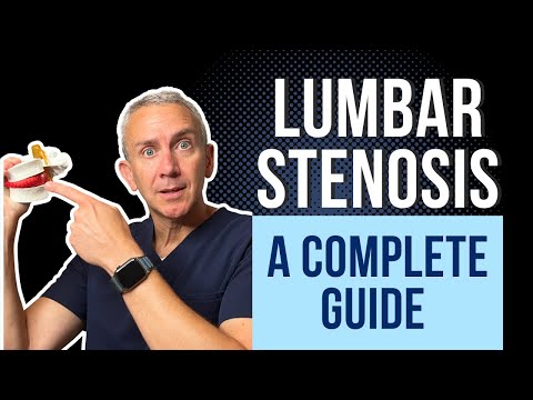 What is Lumbar Spine Stenosis? A Complete Guide to Treatments