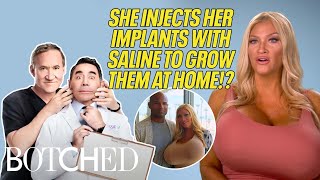 Allegra Keeps EXPANDING Her Breast Implants For Her Husband! | Botched | E!