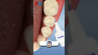 Arayüz fırçası nedir hangi durumlarda kullanılır