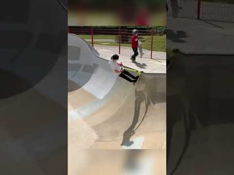 X-Up over Hip (Cantelowes)