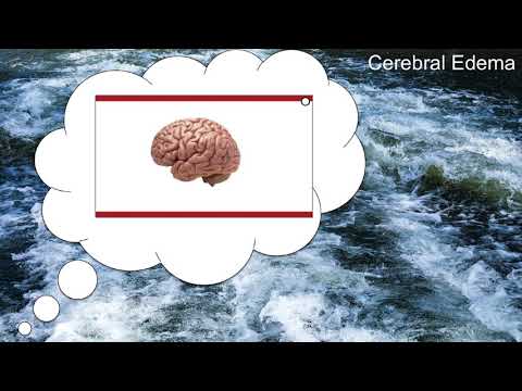 Emergency Management of Hyponatremia  (Part 2)