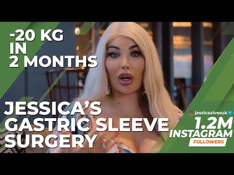 "Gastric Sleeve Surgery Certainly Best Surgery in My Life" Jessica Alves