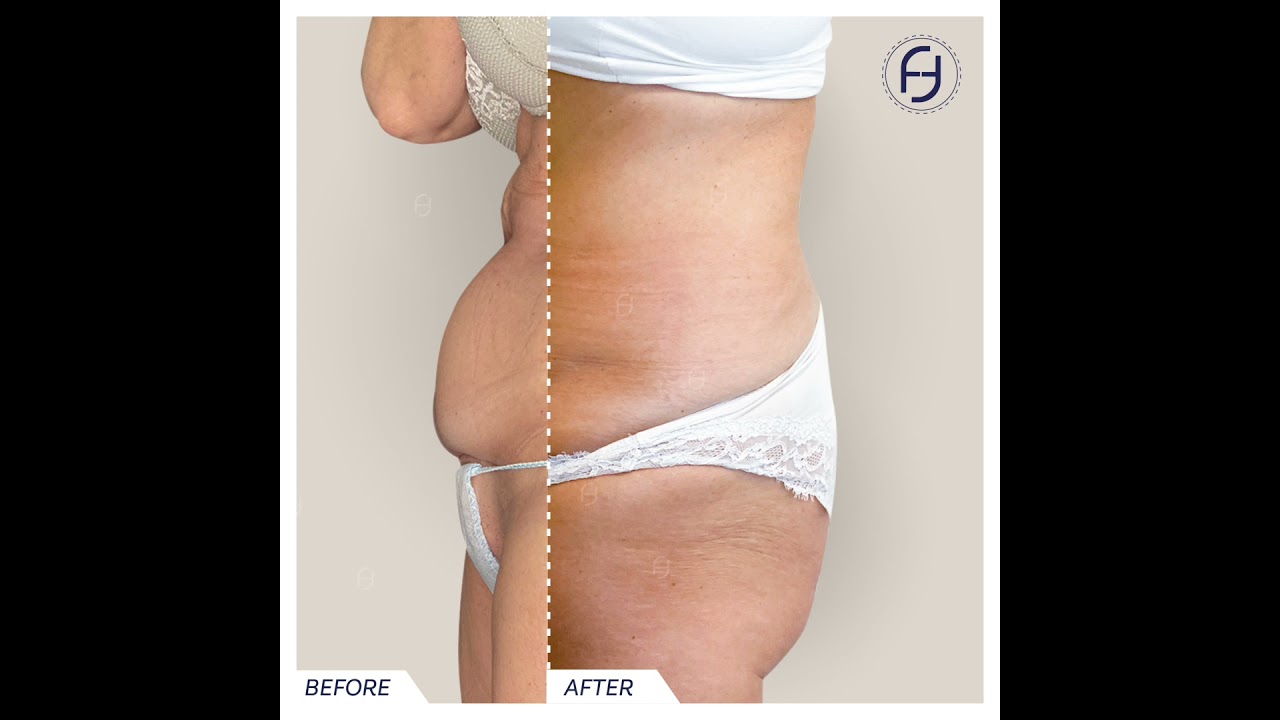 Francesca Flagiello-94