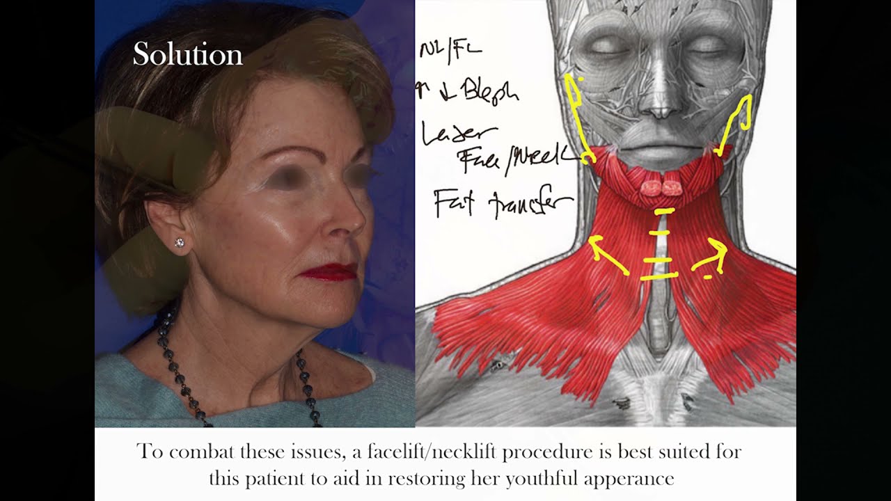 Robb Facial Plastic Surgery