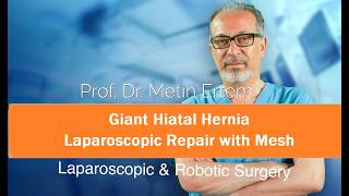 Miniaturka - Giant Hiatal Hernia. Laparoscopic Repair With Mesh. Metin Ertem MD.FACS