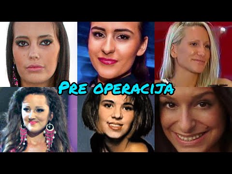 Pevačice pre operacija i estetskih korekcija