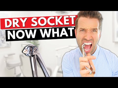 DRY SOCKET - Pain after tooth extraction : causes and cure