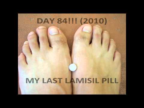 Basag mga kuko ay isang halamang-singaw Peel toenails paggamot