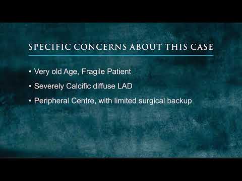 Shockwave Intravascular Lithotripsy by Dr. Omer Hasan