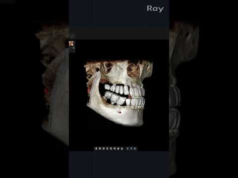 SMARTDent : 5D Tutorial #1-1. 3D Basic Layout Guide