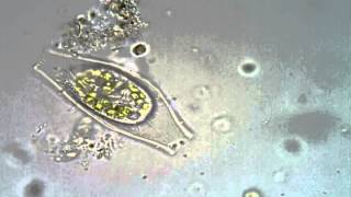 <em>Calyptotricha pleuronemoides</em> (with and without lorica)