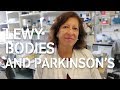 Why are Lewy bodies so important for understanding Parkinson's?