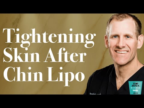 Can I Get Rid of Loose Skin After Chin Lipo?