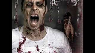 Avulsed - Foetivorous Marriage