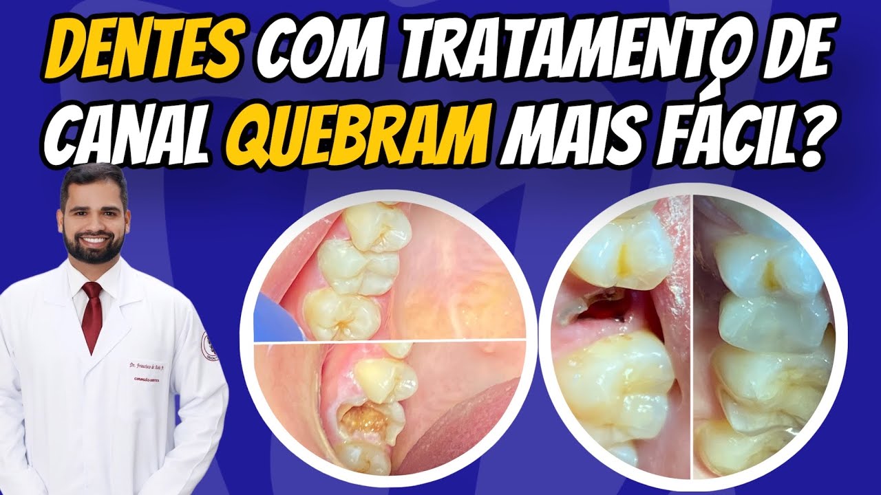 Francisco De Assis Almeida Lima Júnior-71