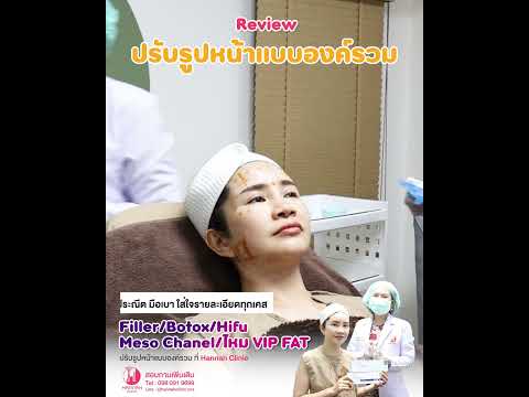 รีวิวหัตถการโปรแกรมปรับรูปหน้าแบบองค์รวมลูกค้าคนจีน