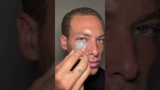 Getting Rid of Eye Bags