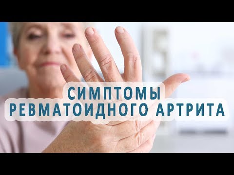 Алоэ от боли в суставах Тяжелое течение шейного остеохондроза