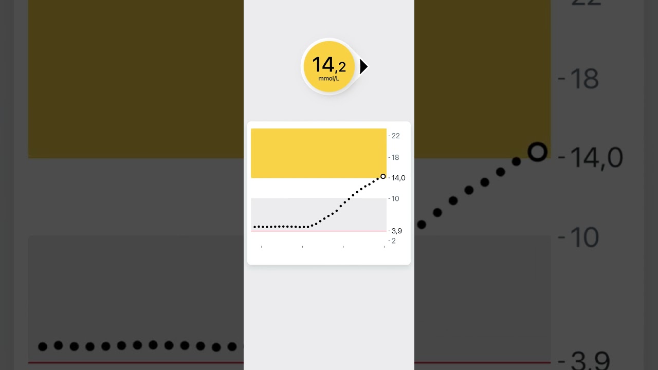 IAV alerts Dexcom ONE+ OUS HR MMOL