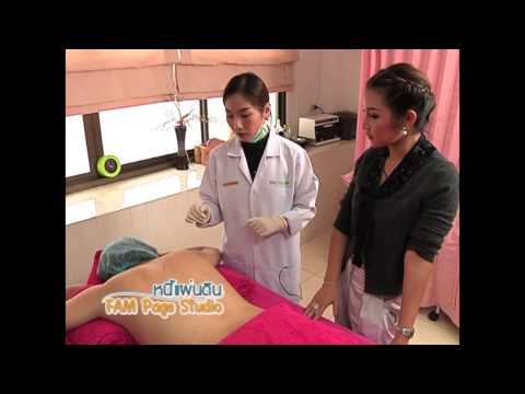 แช่ Podmore สำหรับความแรง Impaza 20 ความคิดเห็น